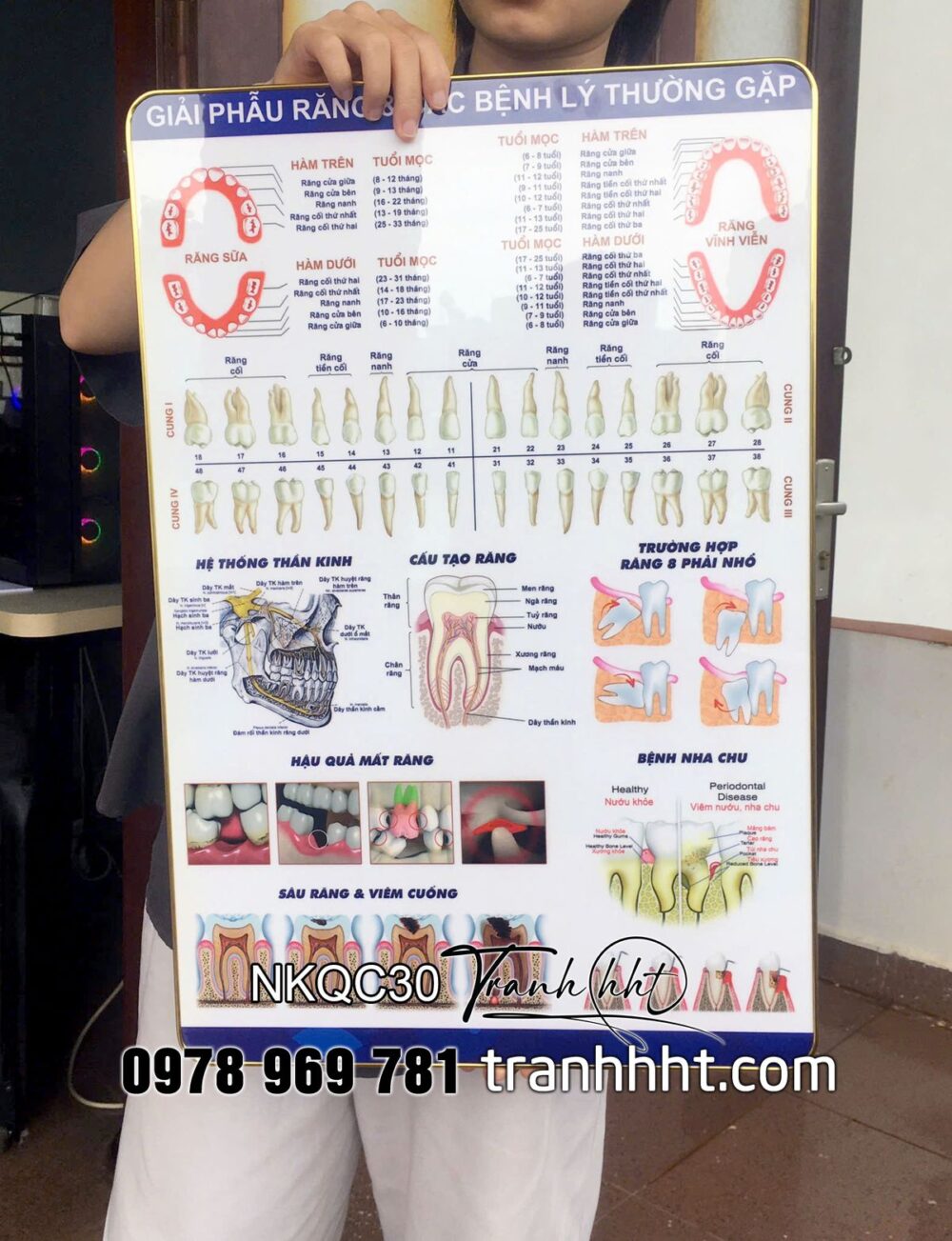 Tranh giải phẫu răng, tranh răng miệng, tranh phòng khám nha, Tranh Nha Khoa giải phẫu răng & các bệnh lí thường gặp tráng gương treo tường NKQC30