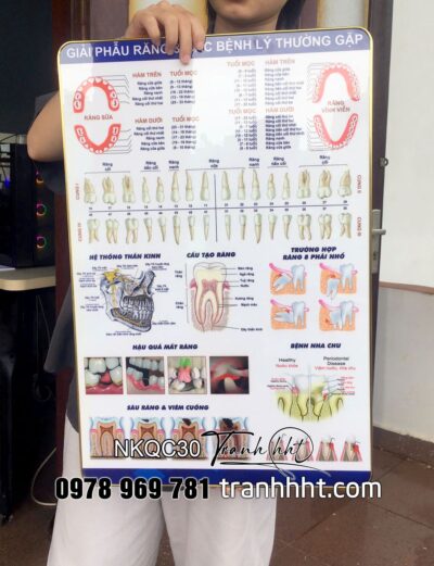 Tranh giải phẫu răng, tranh răng miệng, tranh phòng khám nha, Tranh Nha Khoa giải phẫu răng & các bệnh lí thường gặp tráng gương treo tường NKQC30