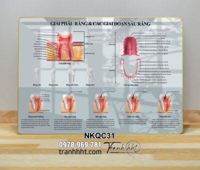 Tranh Nha Khoa NKQC31