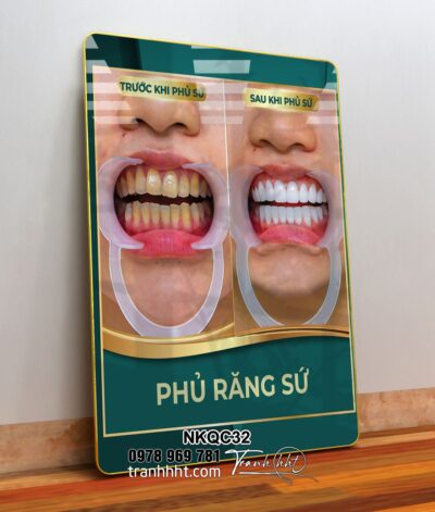 Tranh Nha Khoa NKQC32
