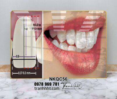 Tranh Nha Khoa NKQC56