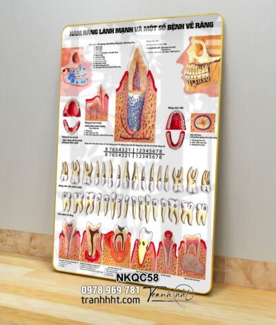 Tranh Nha Khoa NKQC58