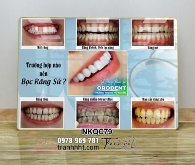 Tranh Nha Khoa NKQC79