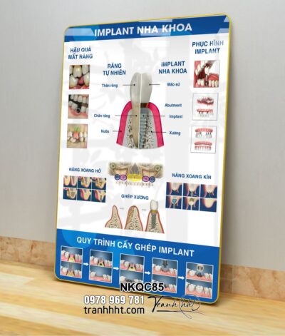 Tranh Nha Khoa NKQC85
