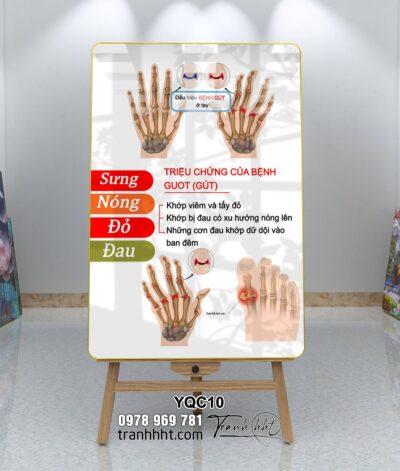 Tranh Y Khoa YQC10