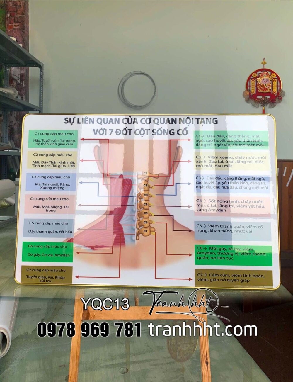 Khung tranh Y Khoa, tranh cơ xương khớp, Tranh Y khoa sự liên quan của cơ quan nội tạng với bảy đốt sống cổ tráng gương treo tường YQC13