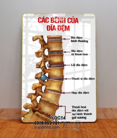 Tranh Y Khoa YQC14