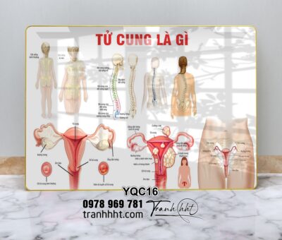 Tranh Y Khoa YQC16