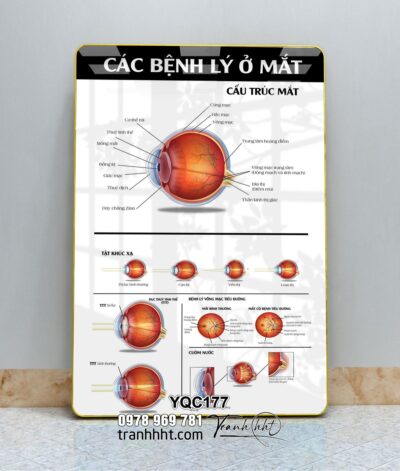 Tranh Y Khoa YQC177