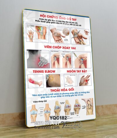 Tranh Y Khoa YQC182
