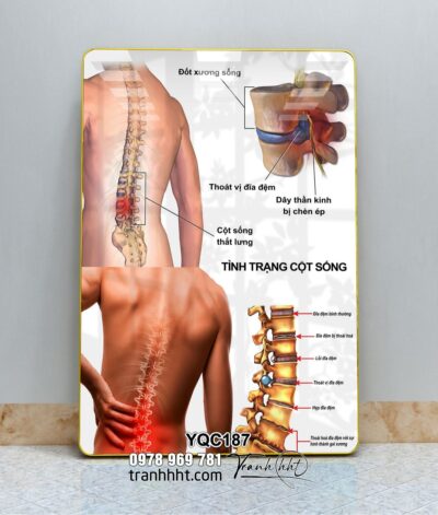 Tranh Y Khoa YQC187