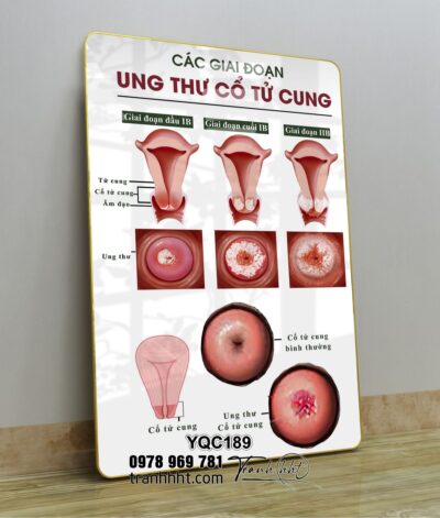Tranh Y Khoa YQC189