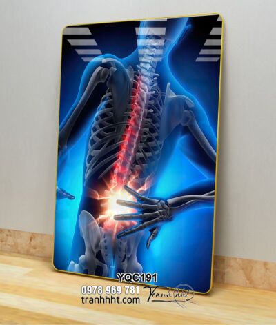 Tranh Y Khoa YQC191