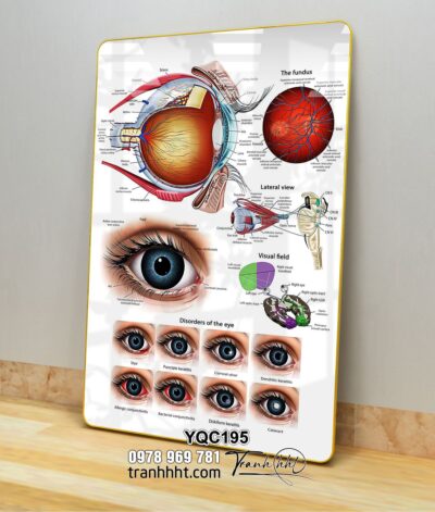 Tranh Y Khoa YQC195