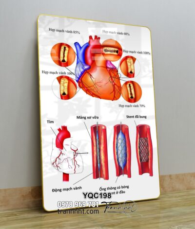 Tranh Y Khoa YQC198