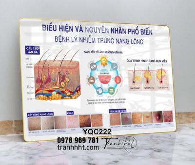 Tranh Y Khoa YQC222