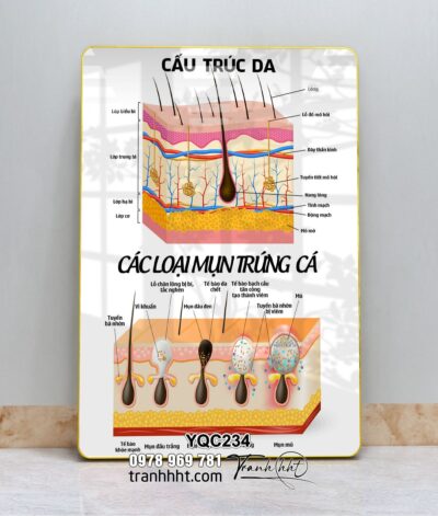 Tranh Y Khoa YQC234