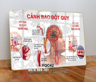 Tranh Y Khoa YQC42