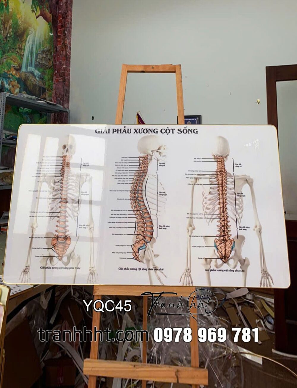 Tranh phòng khám y khoa, tranh phòng khám bác sĩ, Tranh Y khoa huyệt đạo trị liệu giải phẫu xương cột sống tráng gương treo tường YQC45