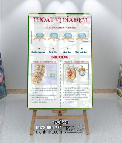 Tranh phòng khám y khoa, tranh xương khớp, tranh đốt sống cổ, Tranh Y khoa triệu chứng bệnh thoát vị đĩa đệm tráng gương treo tường YQC48