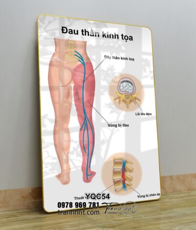 Tranh Y Khoa YQC54