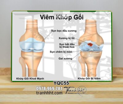 Tranh Y Khoa YQC55
