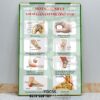Tranh viêm gân, tranh hệ xương khớp, Tranh Y khoa bệnh lý viêm gân cơ thường gặp tráng gương treo tường YQC56