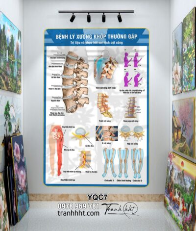 Tranh Y Khoa YQC7