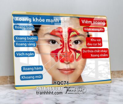 Tranh Y Khoa YQC71