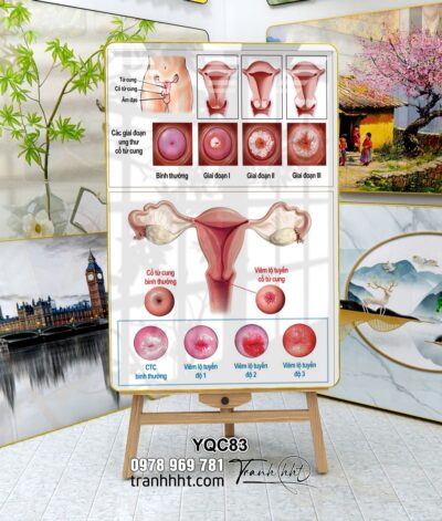 Tranh Y Khoa YQC83