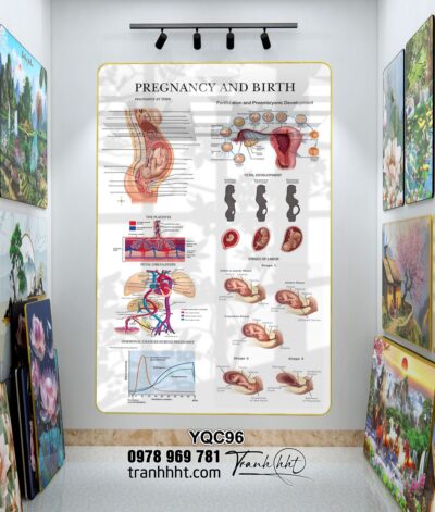 Tranh Y Khoa YQC96