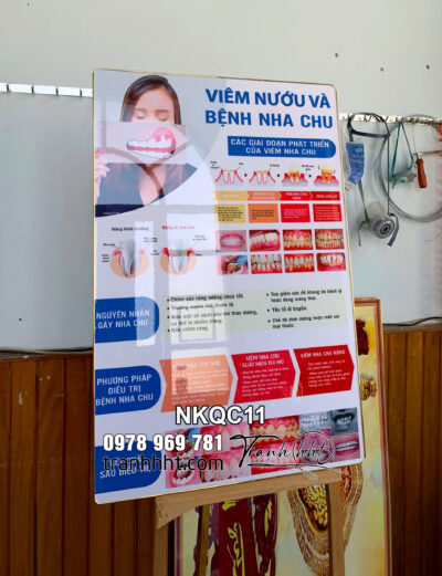 Tranh phòng khám nha khoa, tranh bệnh lý răng miệng, Tranh Nha Khoa viêm nướu và bệnh nha chu tráng gương NKQC11