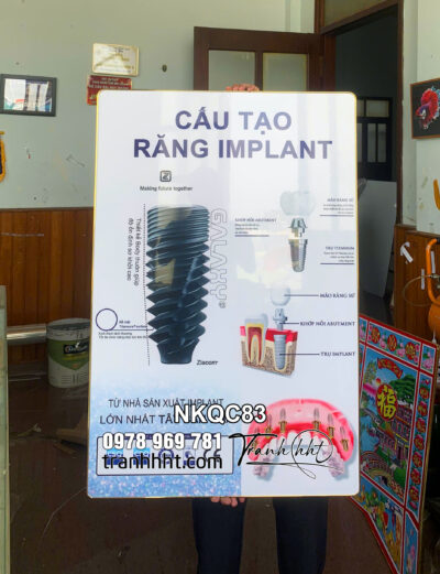 Tranh Phòng khám Nha Khoa, tranh Nha chu, tranh chăm sóc răng miệng cấu tạo răng Implant tráng gương treo tường NKQC83