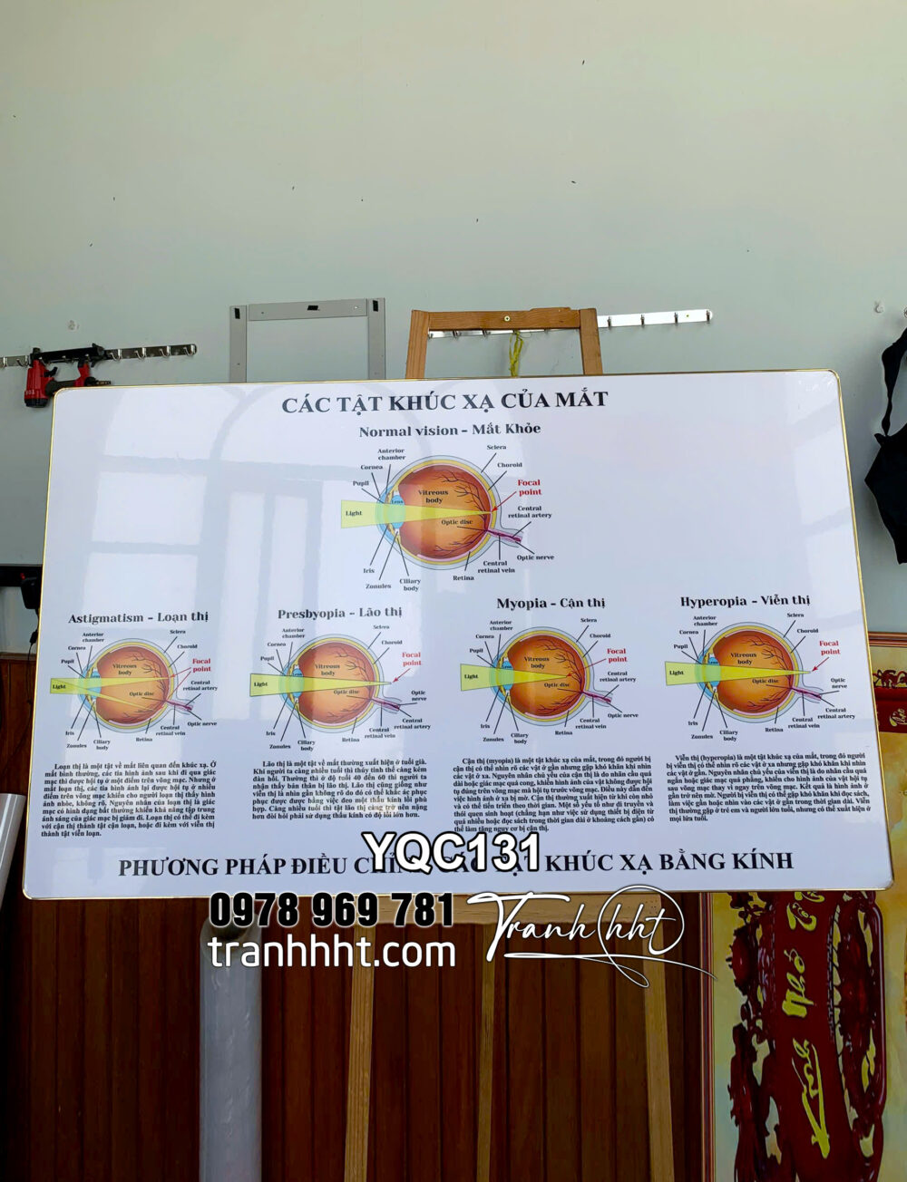 Tranh Y khoa các tật khúc xạ mắt tráng gương treo tường, Tranh bệnh lý mắt, Khung tranh khoa mắt nhãn khoa YQC131