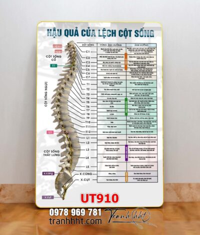 Tranh treo tường UT910